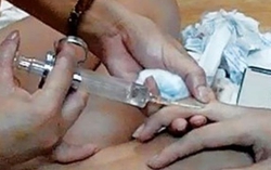 Bỏ mạng vì bơm silicon